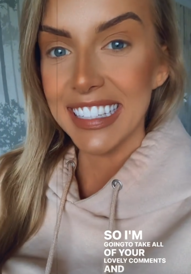 Love Island's Faye Reveals Why She Had To Have Her Lip Fillers Dissolved Stellar