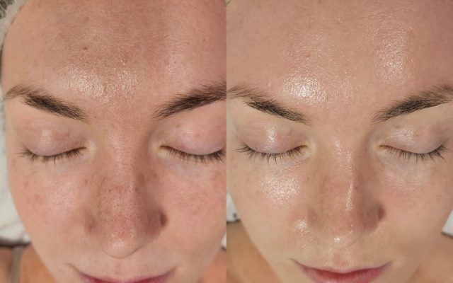 I Tried A Korean Princess Shine Facial – And Now I'm A Believer - Vimarsana News